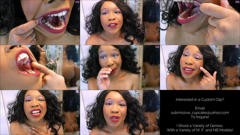 Subbiecupcake A Second Look At My Terrible Teeth