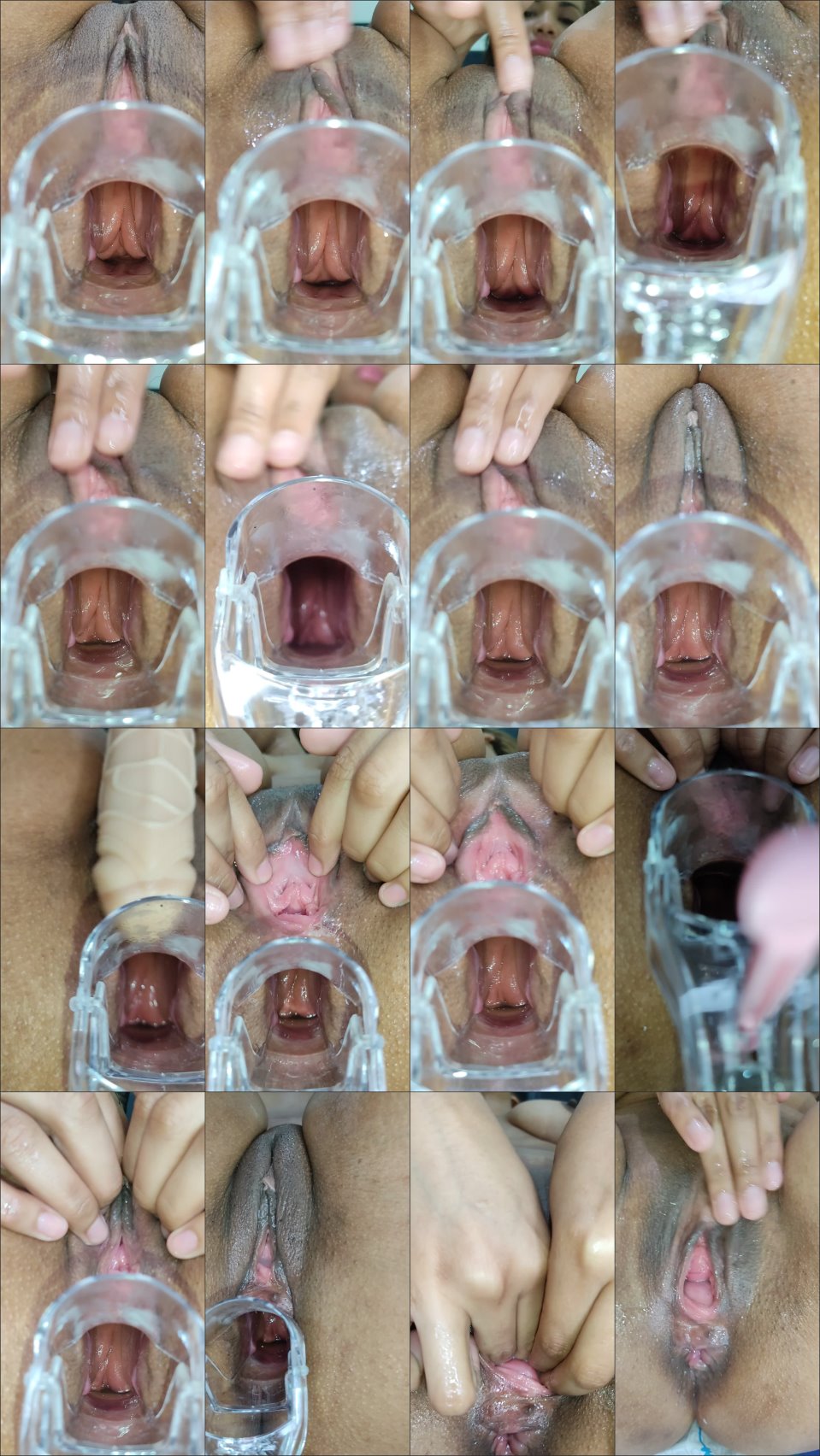 Xamy 97 Nice View Of A Speculum In My Big Ass