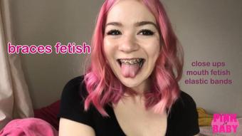 braces fetish (pinkbaby24)