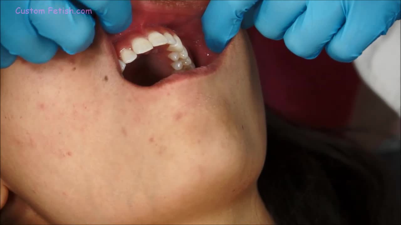 Amber's Topless Mouth Exam