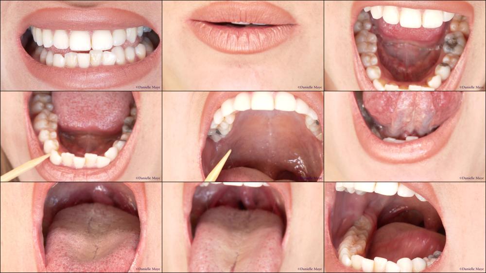 Exploring Danis Mouth Tongue  Throat - October 04, 2015