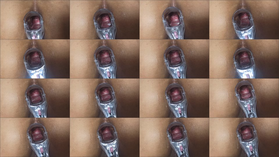 Xamy 97 Speculum In My Anus Part 2