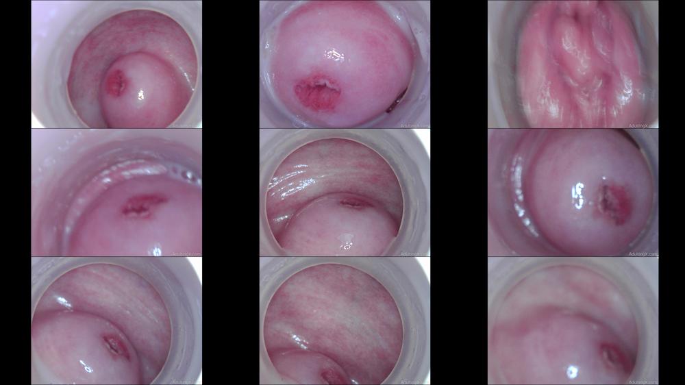 Raw: Beautiful Cervix Inside Pussy - Nov 16, 2021