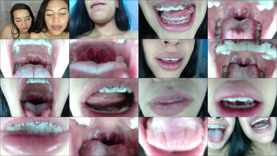 Miaisabella3 Braces Mouth Uvula Fetish