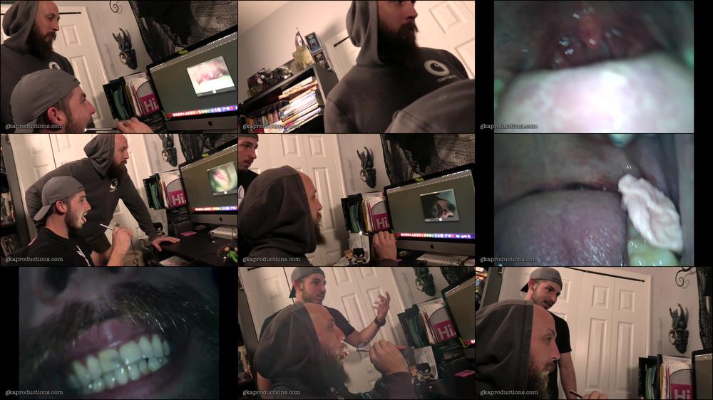 Dustin & Toby Endoscope Mouth Tour