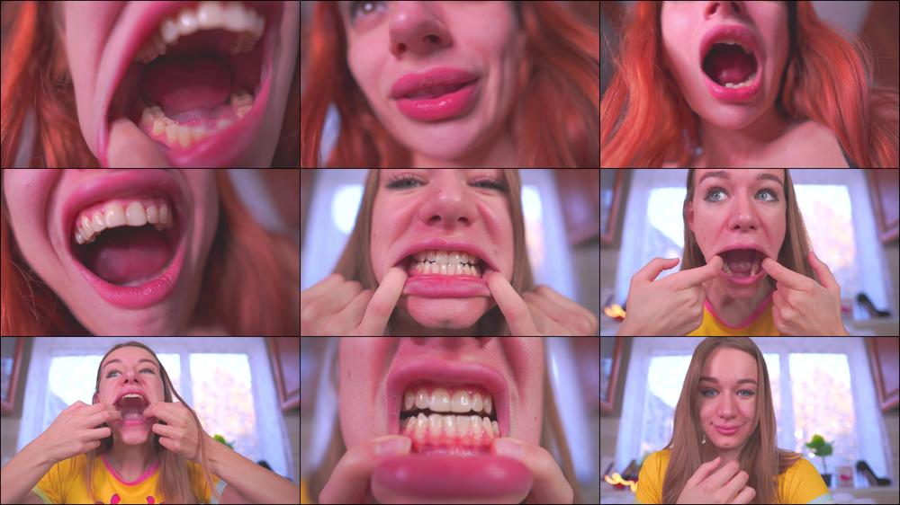Teeth Fetish Healthy Crooked Caries