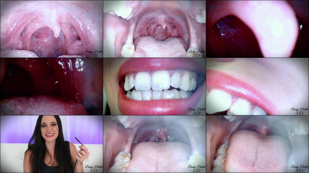 Dacey's Endoscope Mouth Tour - December 12, 2022