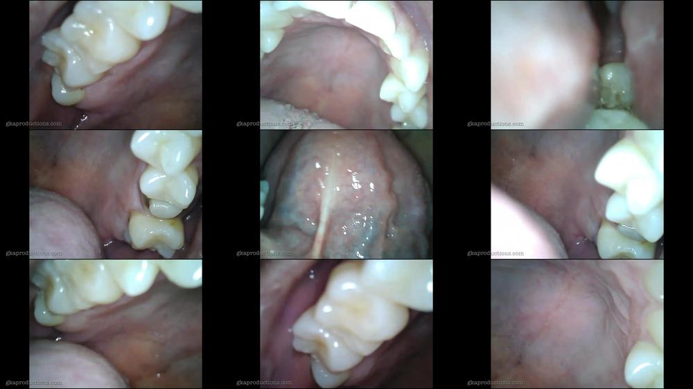 Mouth Inspection With Tony Dinozzo