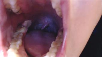 Mouth And TOngue Veins (PrincessDi)