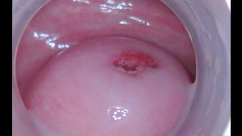 Raw: Beautiful Cervix Inside Pussy - Nov 16, 2021 (adulting)
