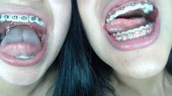 Miaisabella3 Braces Mouth Uvula Fetish (mia_isabella3)
