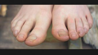 Dirty Feet and Long Toes - July 06, 2021 (FFeZine)