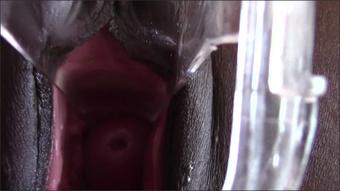 Totalpussy Secretarys Speculum Cervix (TotalPussy)