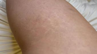Stretch Mark Fetish 4K (kristinaxxx)