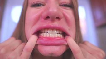 Teeth Fetish Healthy Crooked Caries (margolisa)