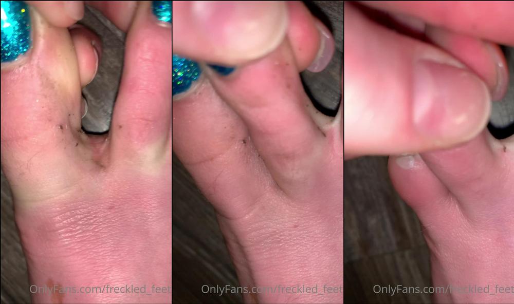 freckled_feet 02 10 2020 987780800 WARNING  TOE JAM CONTENT AHEAD. Look away if you donât wanna see
