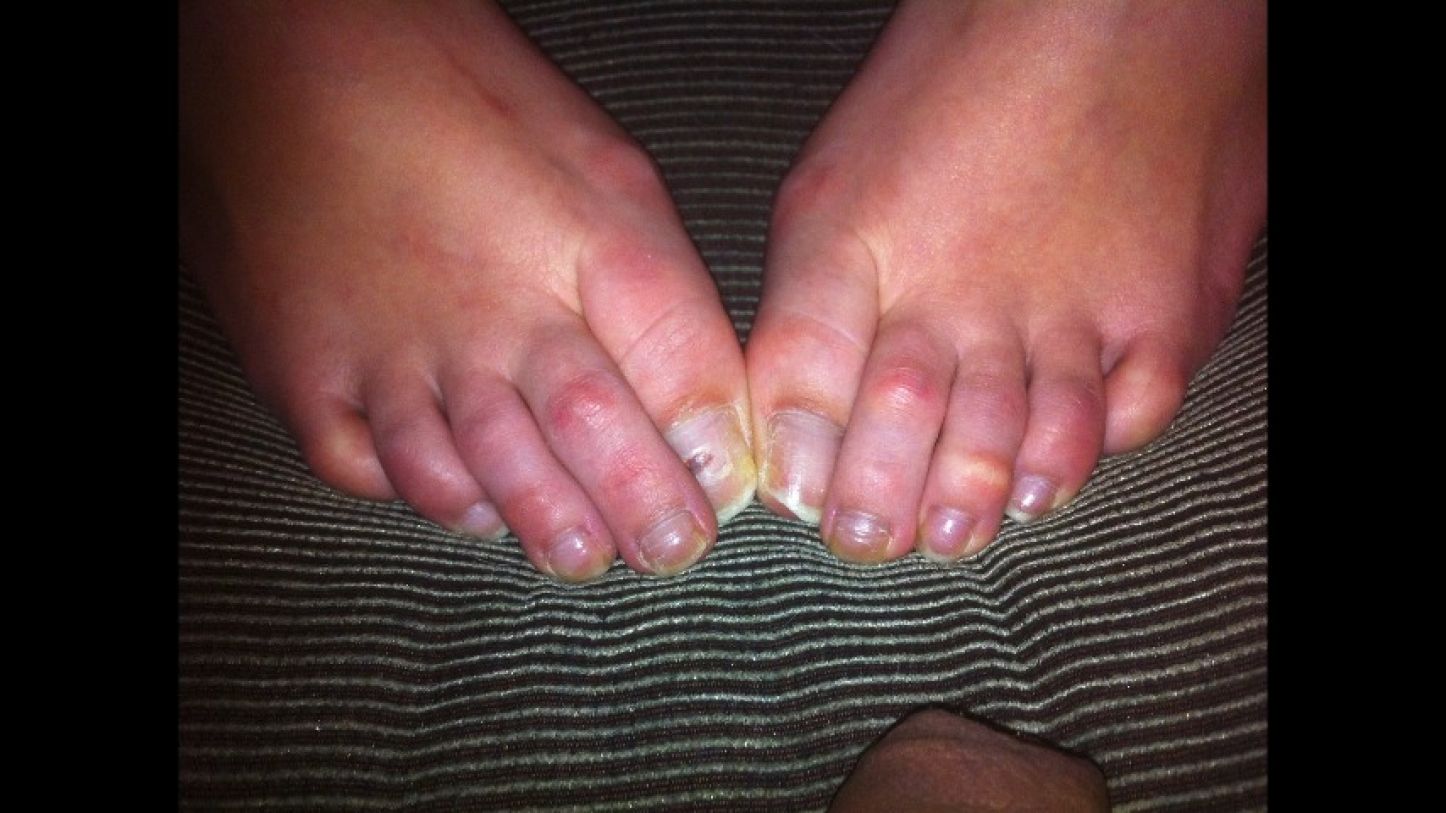 RAW NATURAL TOES - PHOTO VIDEO - February 14, 2024