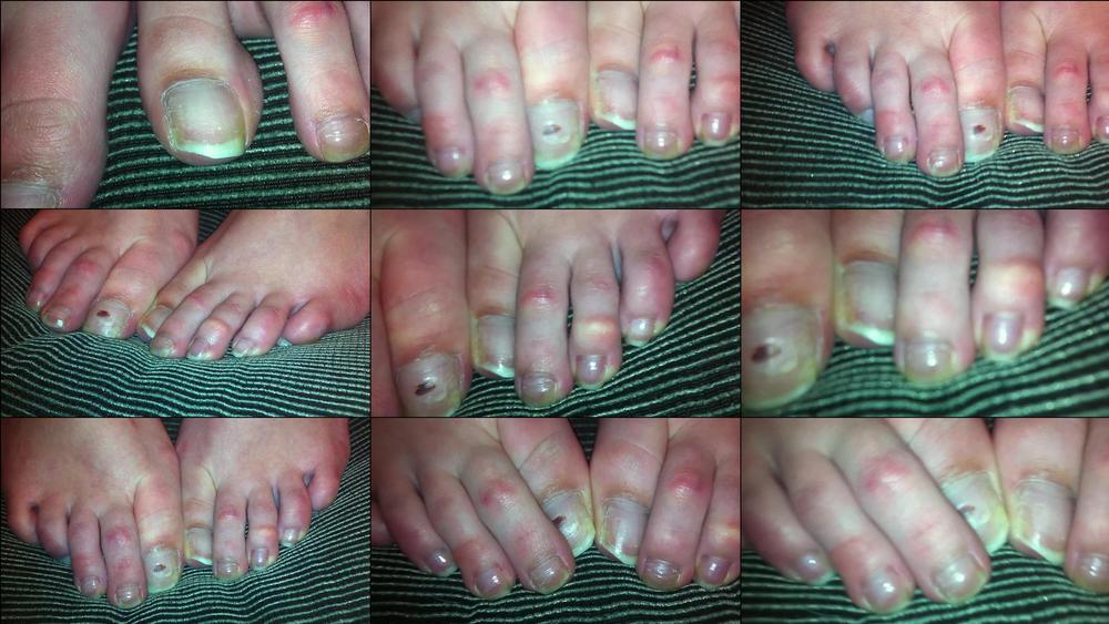 RAW NATURAL TOES - February 13, 2024