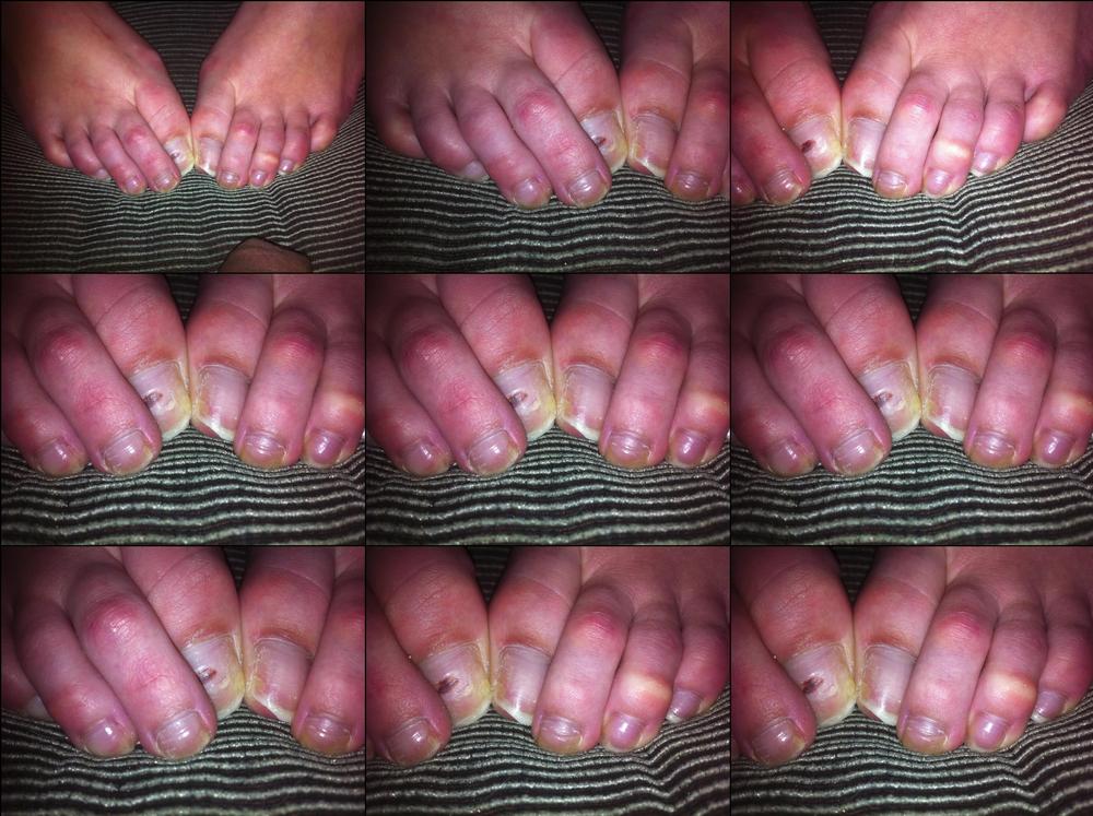 RAW NATURAL TOES - PHOTO VIDEO - February 14, 2024