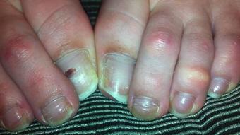 RAW NATURAL TOES - February 13, 2024 (bestfootjobs)