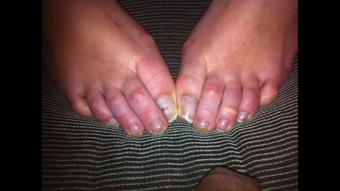 RAW NATURAL TOES - PHOTO VIDEO - February 14, 2024 (bestfootjobs)
