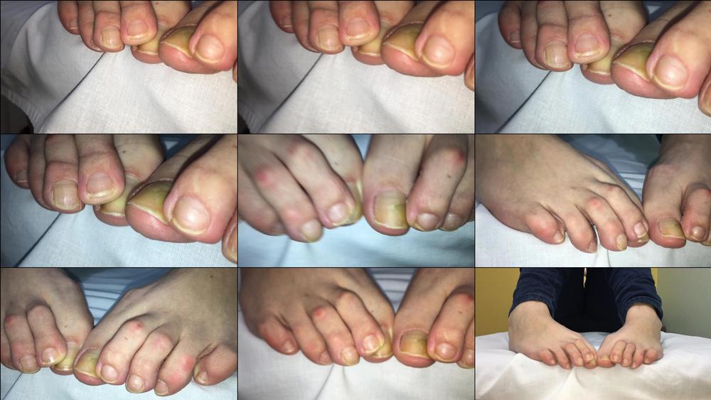 UNPOLISHED TOES CLOSE UP - October 30, 2023