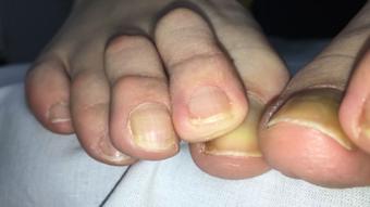UNPOLISHED TOES CLOSE UP - October 30, 2023 (bestfootjobs)